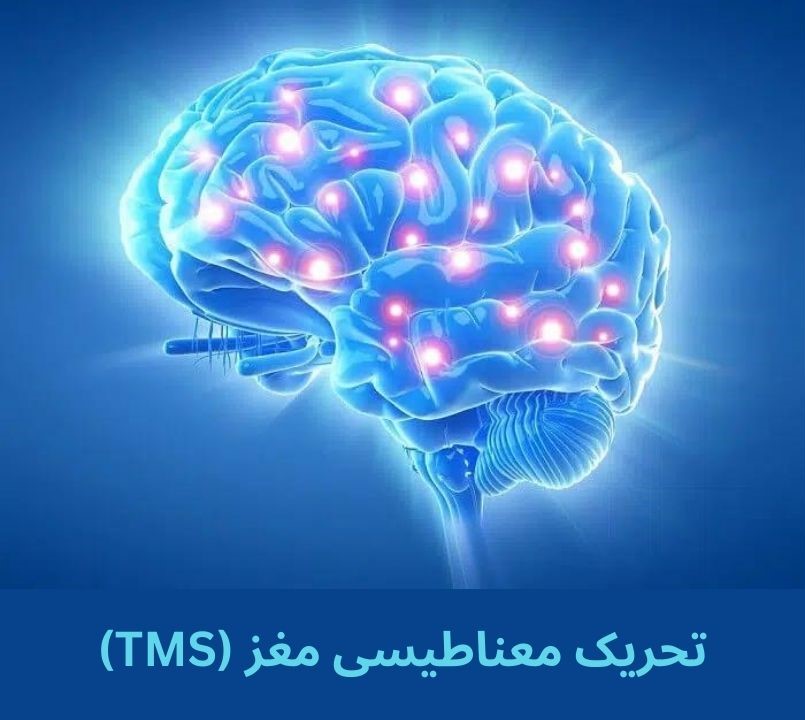 تحریک معناطیسی مغز (TMS)